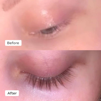 Eyelash Serum